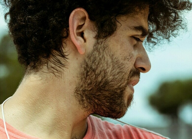 Изображение Акне у мужчины: откуда берется во взрослом возрасте и что с этим делать